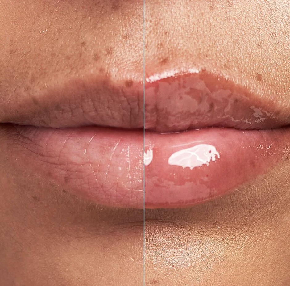 DermInfusions Plump + Repair Lip Treatment - Bilde 2